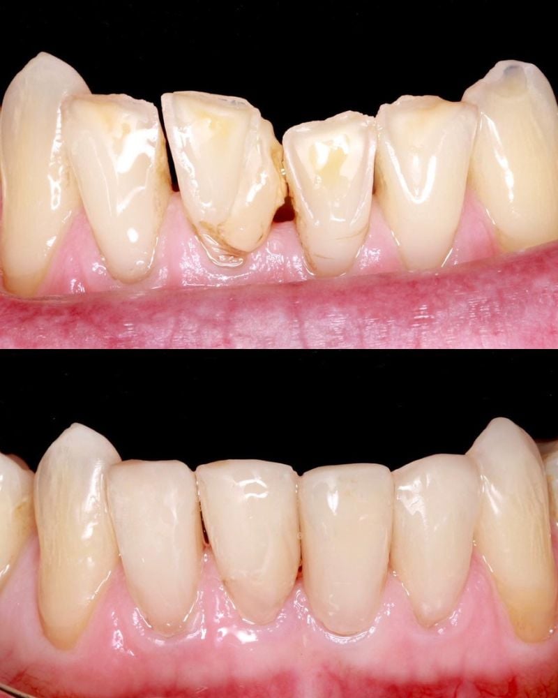 Before & after treatment with Sam