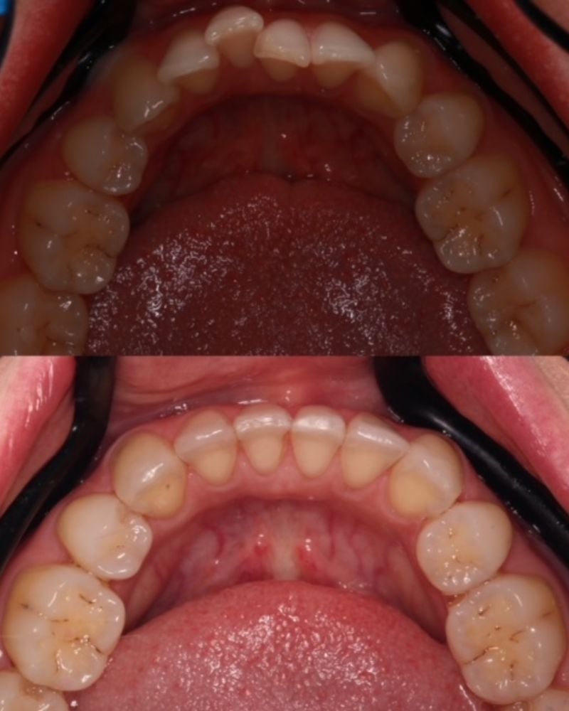 Before & after treatment with Sam