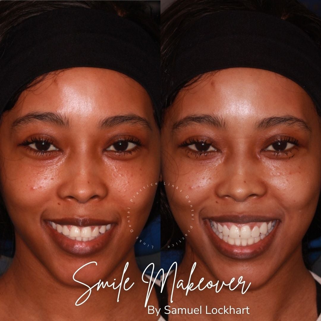 Links Dental Practice | Smile Makeovers