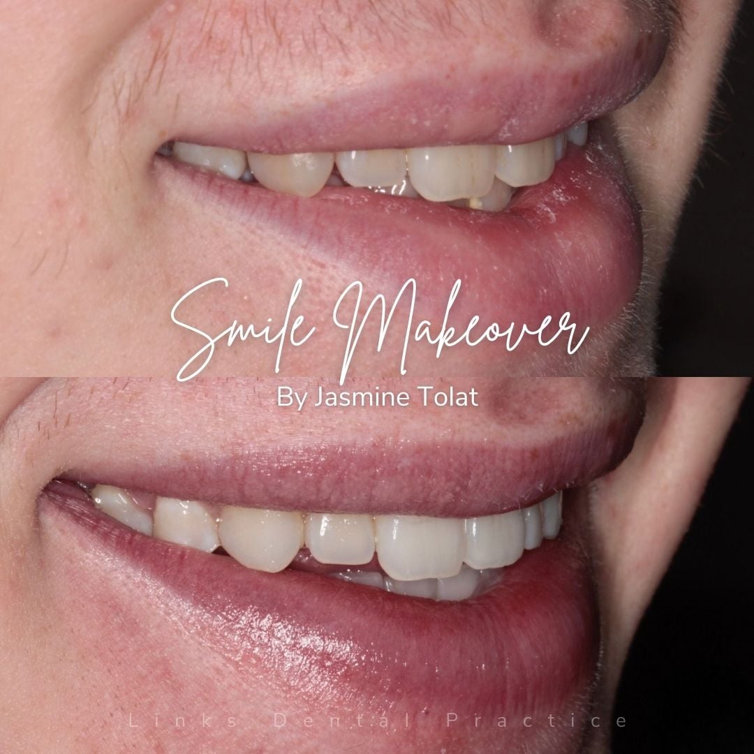 Links Dental Practice | Smile Makeovers