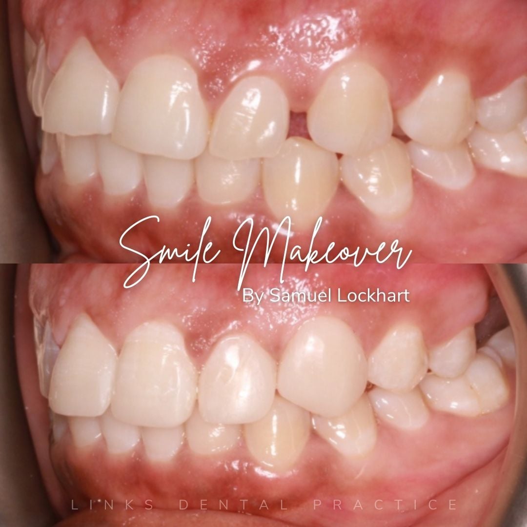Links Dental Practice | Smile Makeovers
