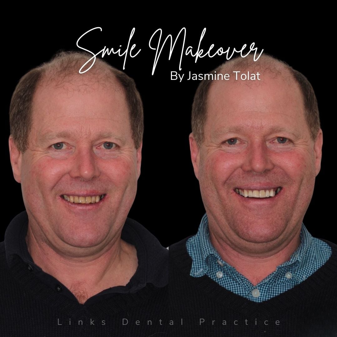 Links Dental Practice | Smile Makeovers