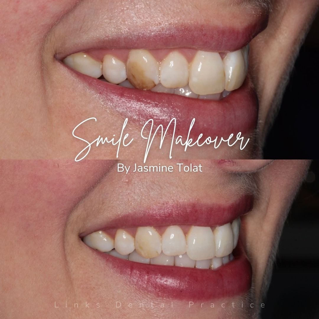 Links Dental Practice | Smile Makeovers