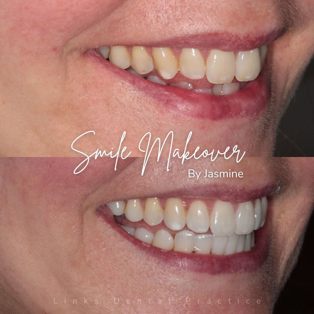 Links Dental Practice | Smile Makeovers