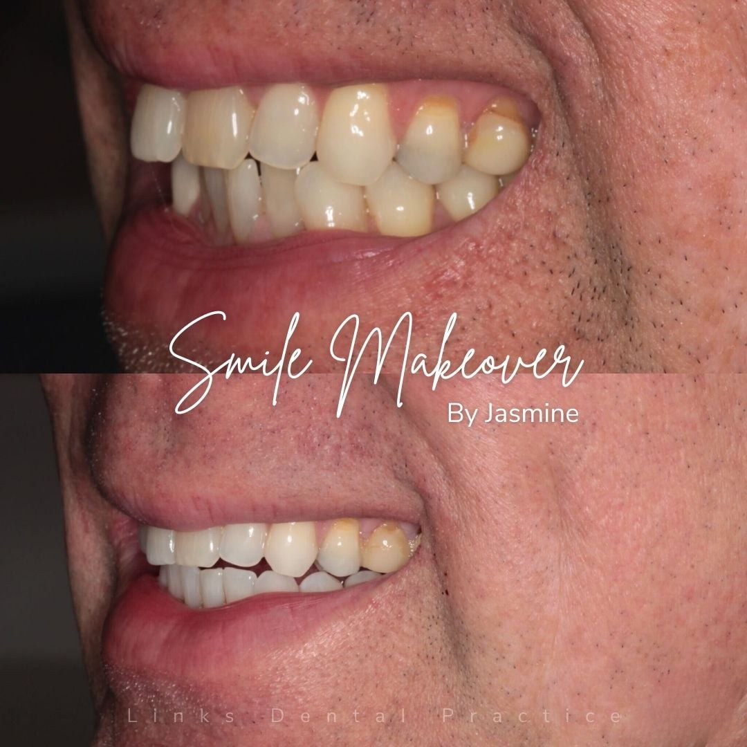 Links Dental Practice | Smile Makeovers