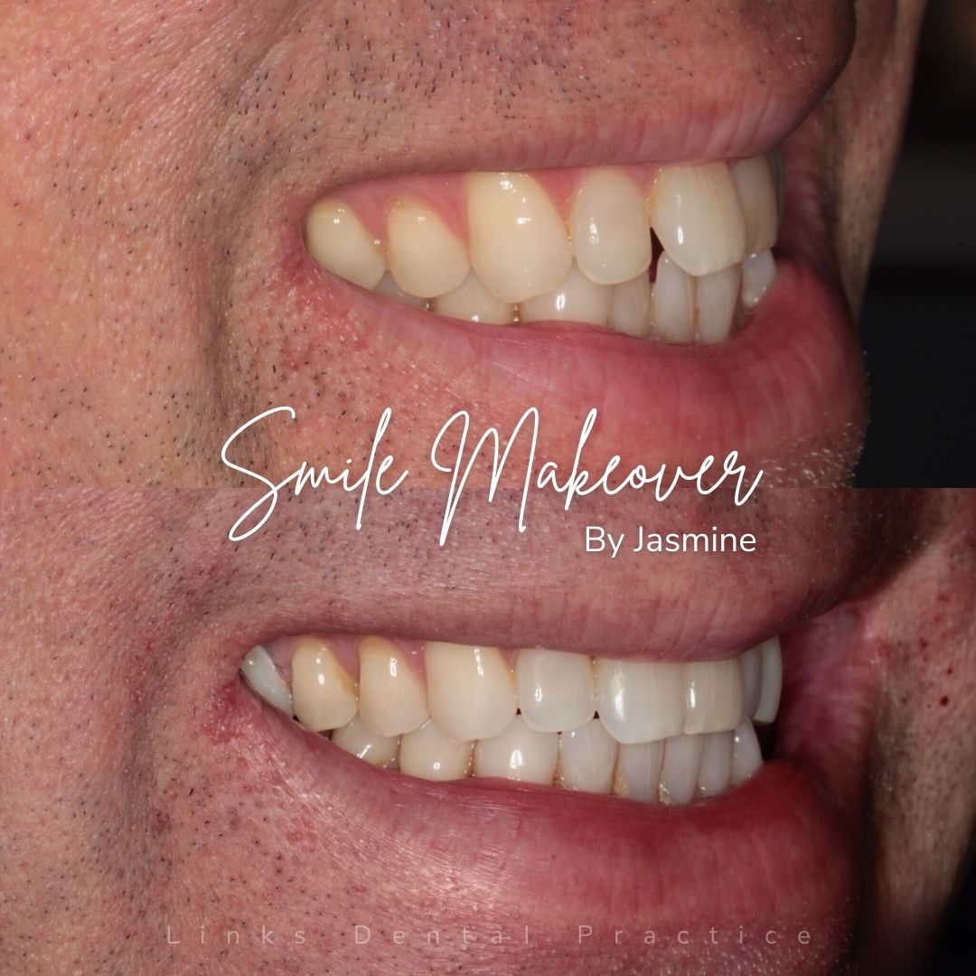 Links Dental Practice | Smile Makeovers