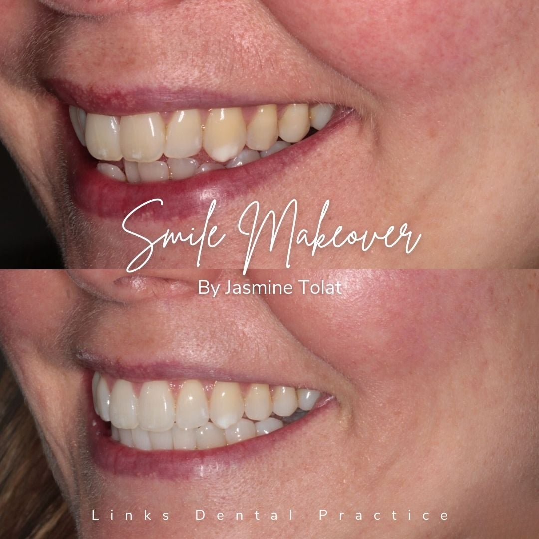 Links Dental Practice | Smile Makeovers
