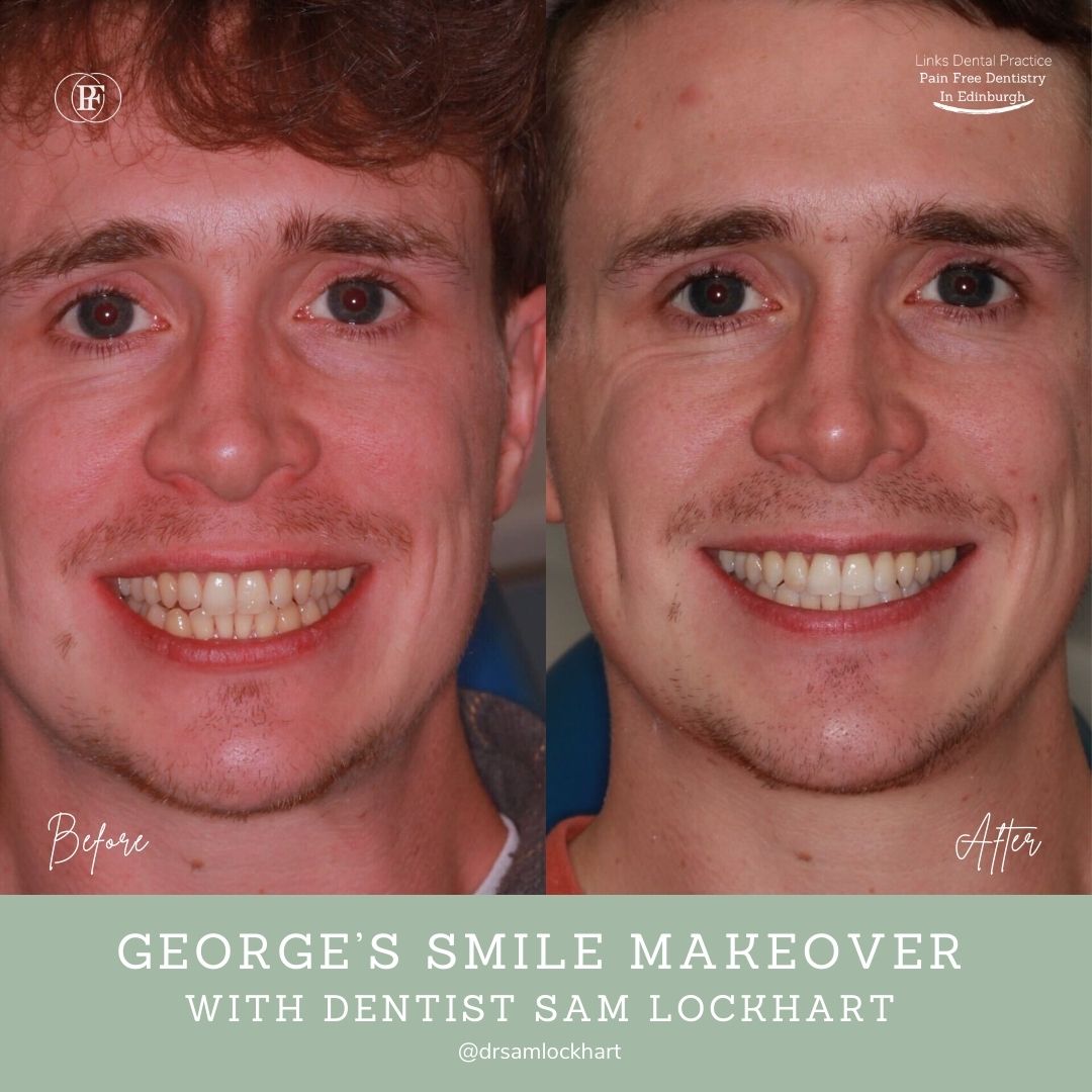 Links Dental Practice | George's Smile Story Jane's smile makeover