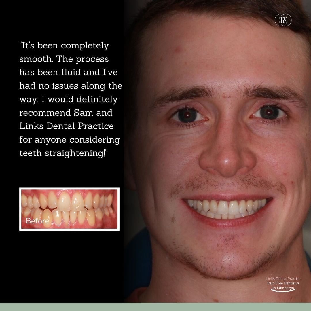 Links Dental Practice | George's Smile Story Jane's smile makeover
