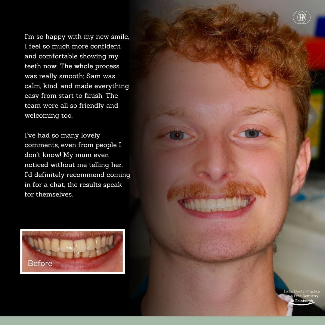 Links Dental Practice | Adam's Smile Story Adam Russell's - Samuel Lockhart (1080 x 1080 px) (4)
