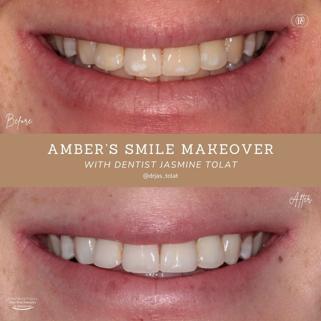 Links Dental Practice | Amber's Smile Story Amber's Smile Story with Jasmine Tolat