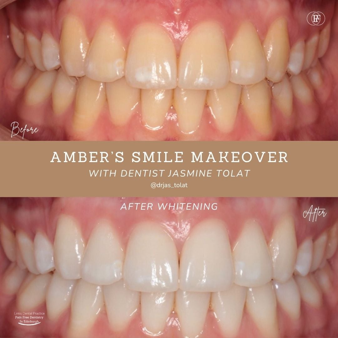 Links Dental Practice | Amber's Smile Story Amber's Smile Story with Jasmine Tolat