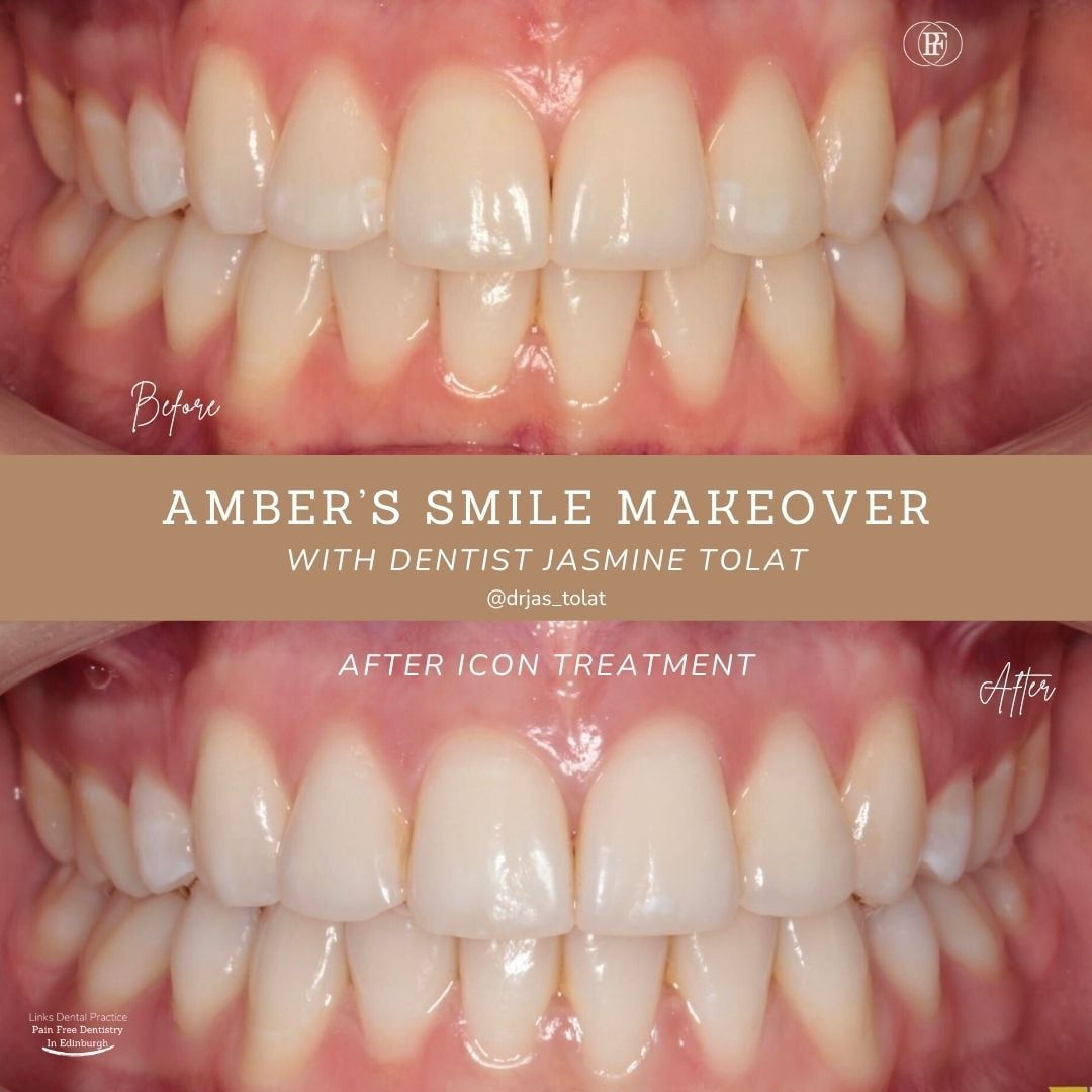 Links Dental Practice | Amber's Smile Story Amber's Smile Story with Jasmine Tolat