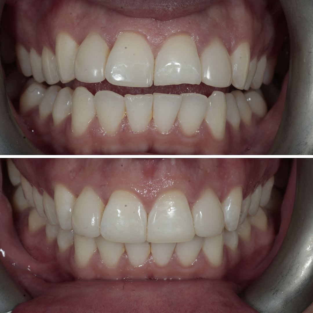 Links Dental Practice | Dr Jennie Forss Jennie Forss (4)