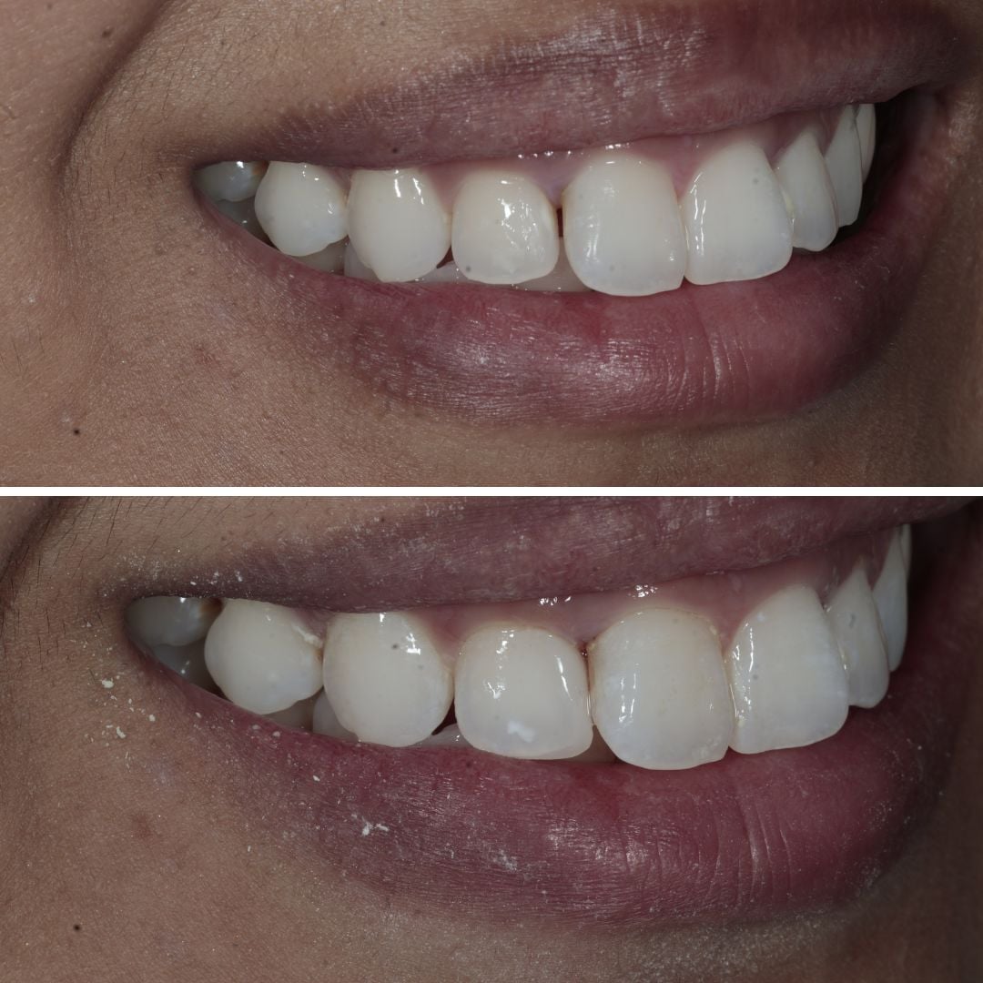 Links Dental Practice | Dr Jennie Forss Jennie Forss (4)