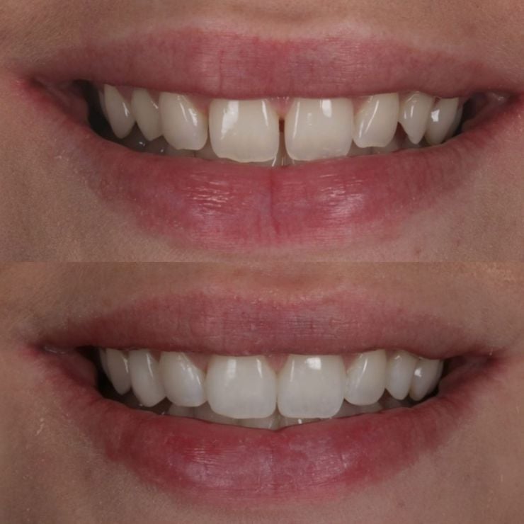 Transforming Smiles