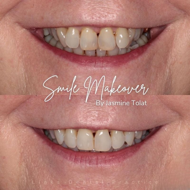 Links Dental Practice | Smile Makeovers