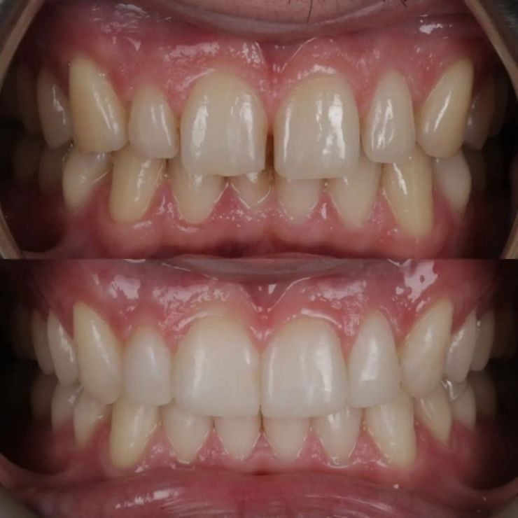Transforming Smiles