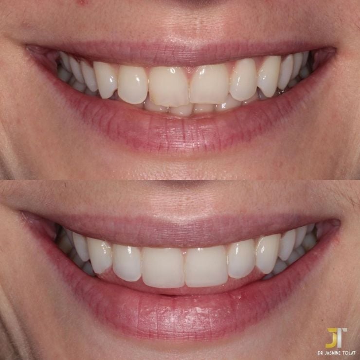Transforming Smiles