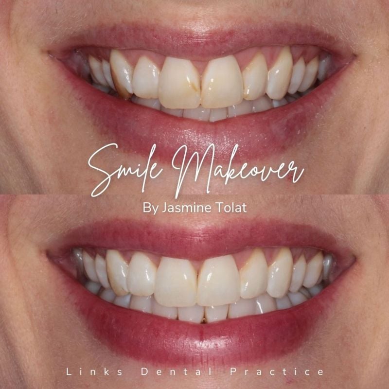 Links Dental Practice | Smile Makeovers