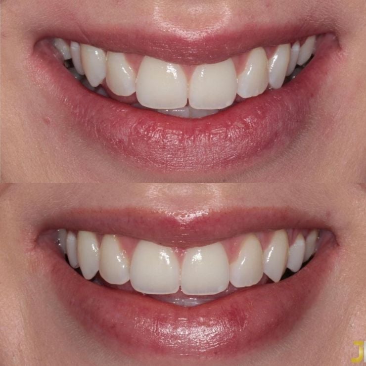 Transforming Smiles