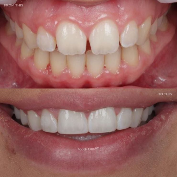 Transforming Smiles