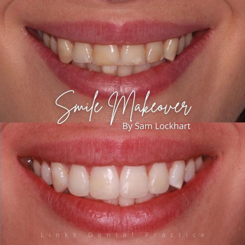 Links Dental Practice | Smile Makeovers