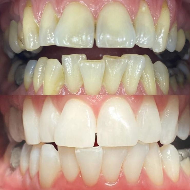 Transforming Smiles