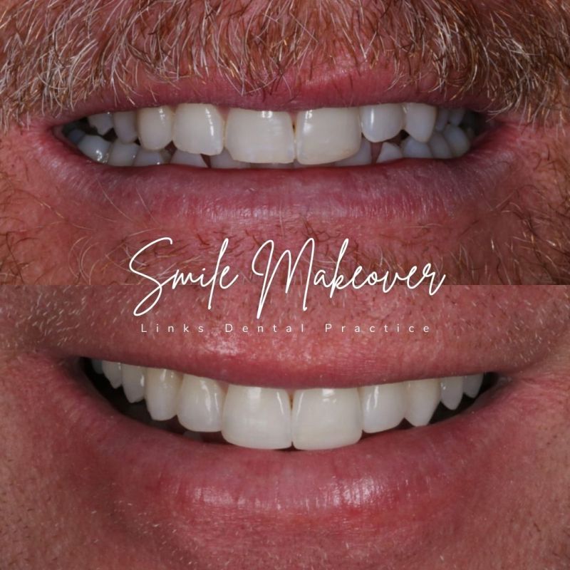 Links Dental Practice | Smile Makeovers