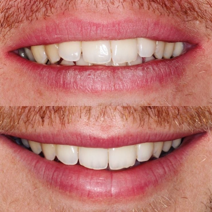 Transforming Smiles