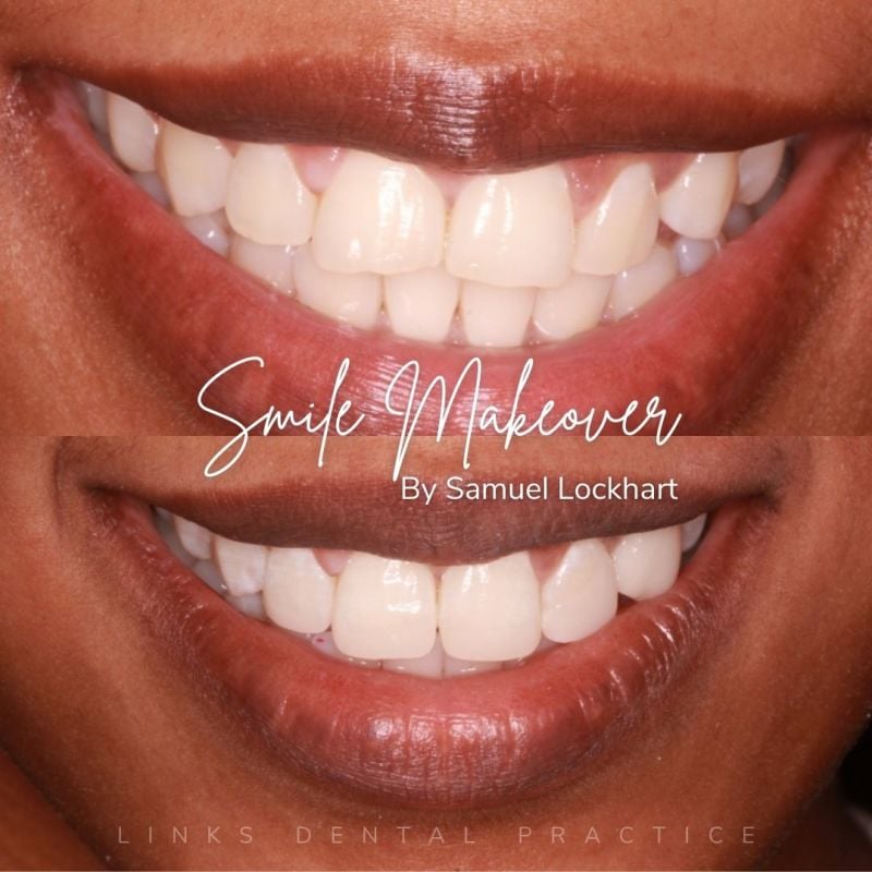 Links Dental Practice | Smile Makeovers