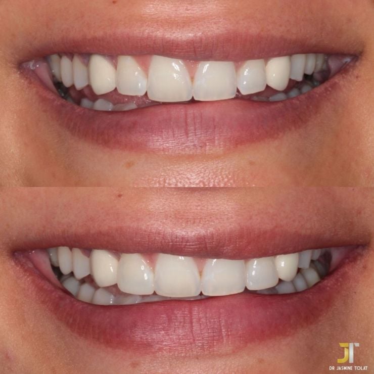 Transforming Smiles