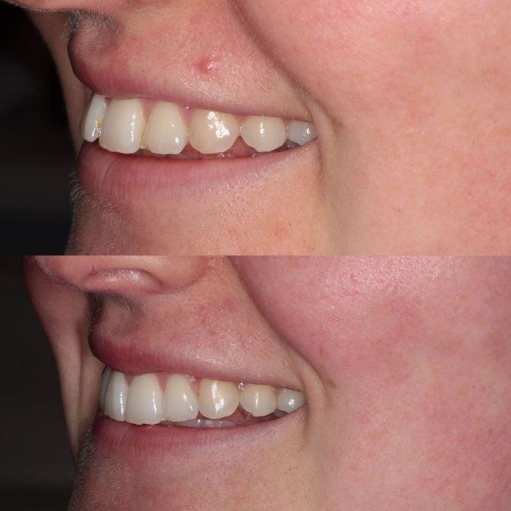 Transforming Smiles