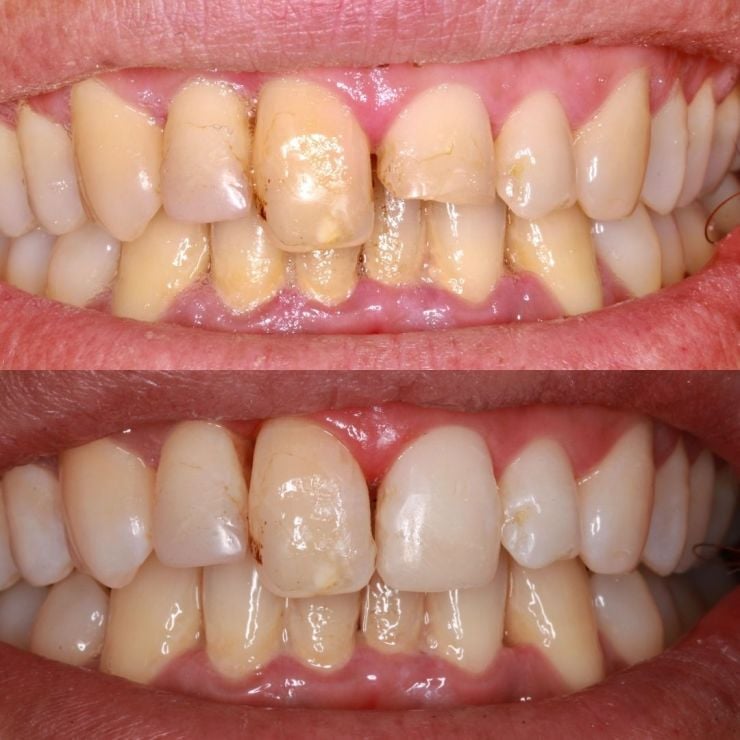 Transforming Smiles