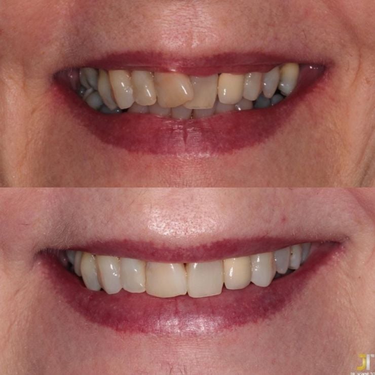 Transforming Smiles