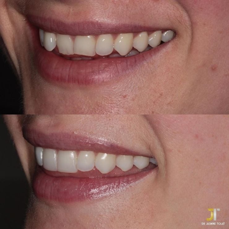 Transforming Smiles