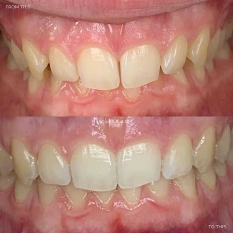 Transforming Smiles