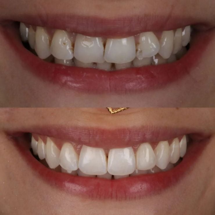 Transforming Smiles