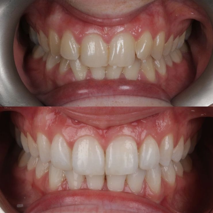 Transforming Smiles