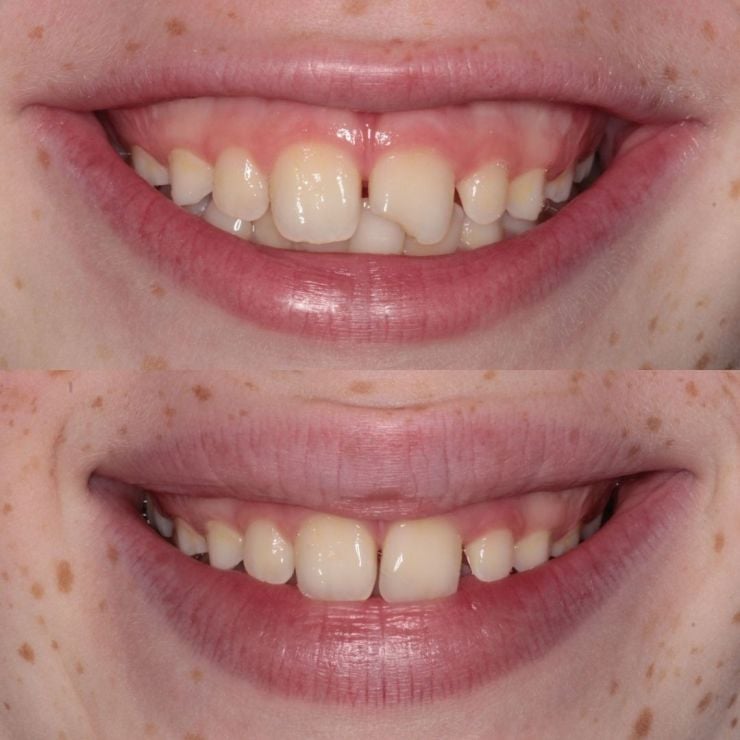 Transforming Smiles